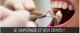 fumer vapoter opération dent