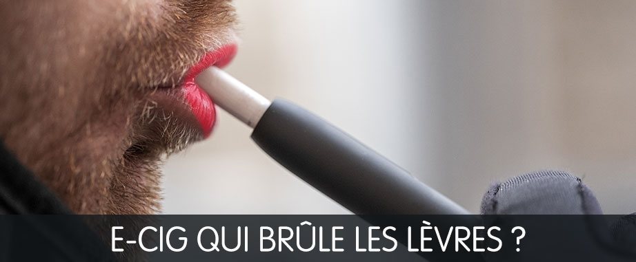e-cg me brule les levres
