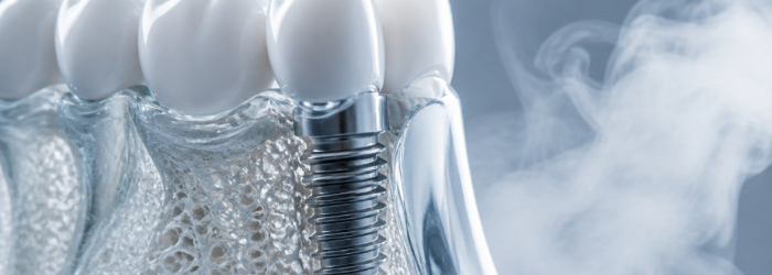 e cigarette et implant dentaire