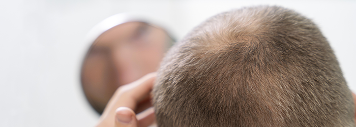 vapotage et perte de cheveux