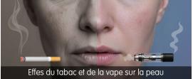 effet tabac ou vape sur la peau