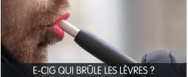 e-cg me brule les levres